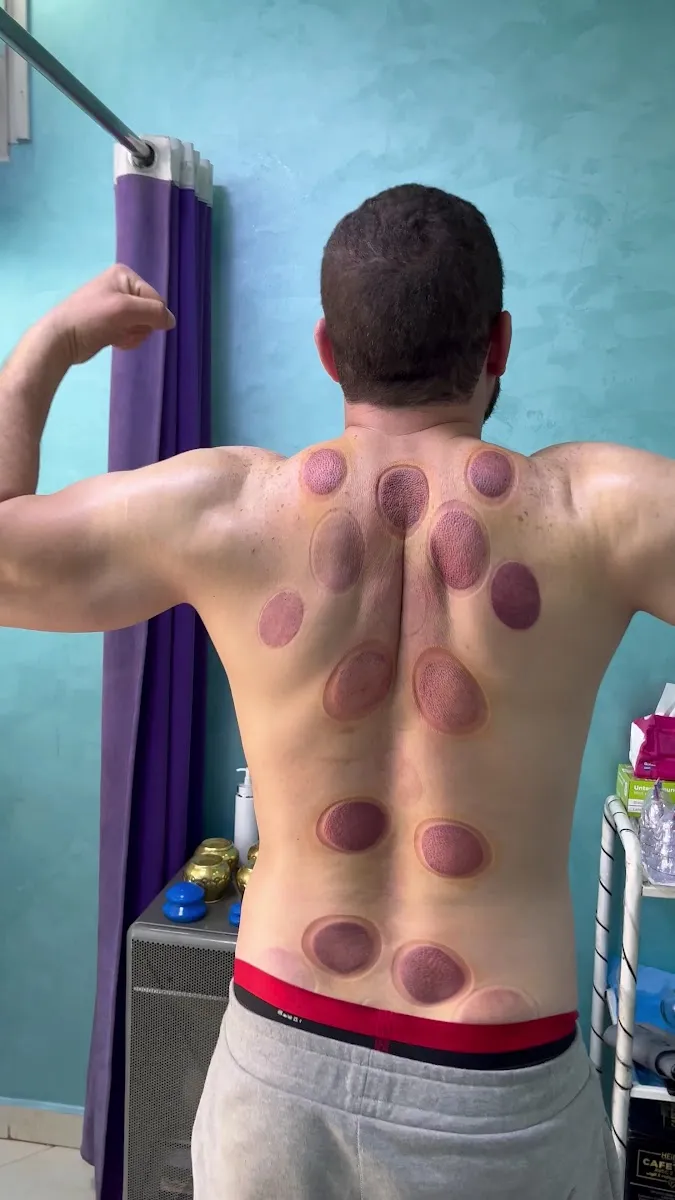 Photo 3 de Centre hijama morad عيادة مراد للحجامة الطبية