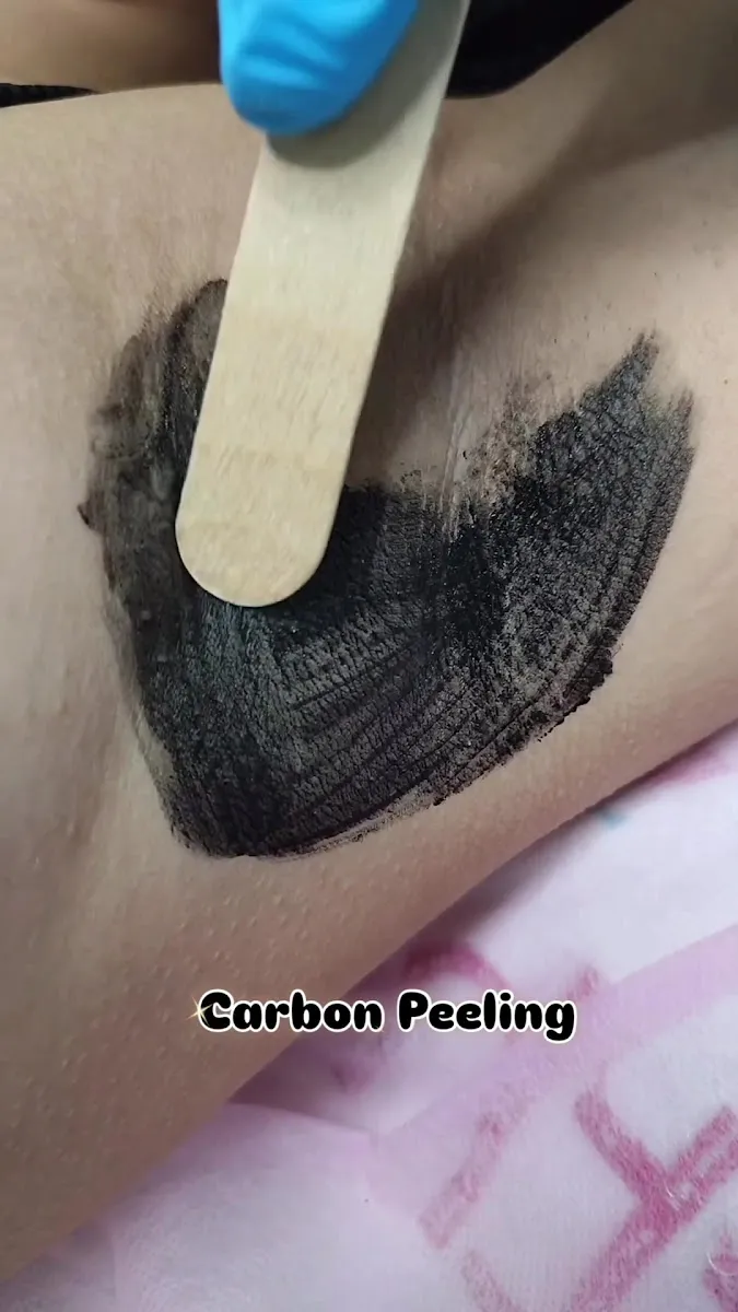 EstheBella Epilation&Beauté Centre 🇹🇷 photo 3