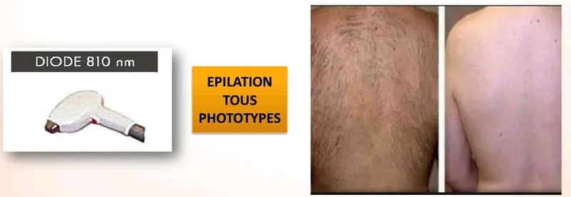 Photo 2 de Docteur Dermatologue Soufiane ABDELLAOUI