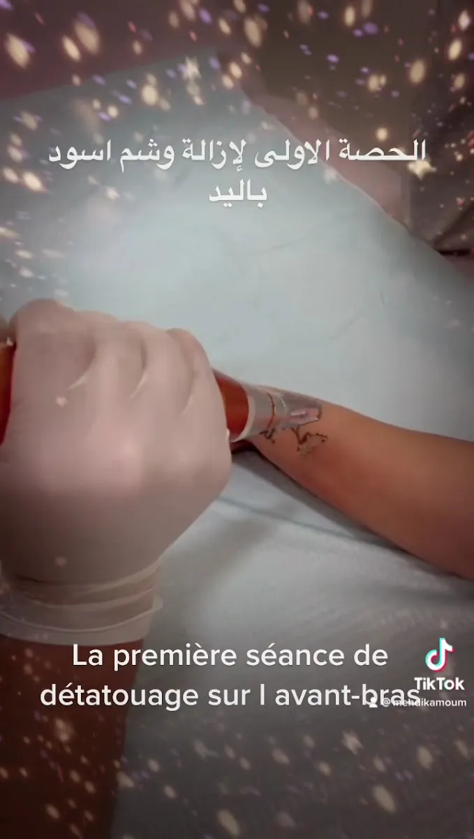 Photo 1 de عيادة الترويض الطبي كلميم Cabinet Mehdi Kamoum de laser, kinésithérapie et physiothérapie