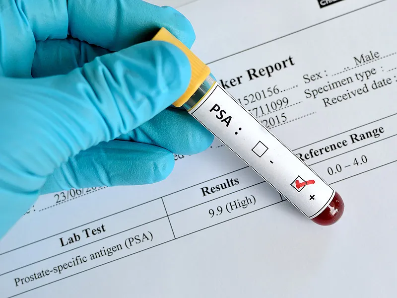 Dr Khdach Youness chirurgien Urologue Sexologue Andrologue Rabat photo 4
