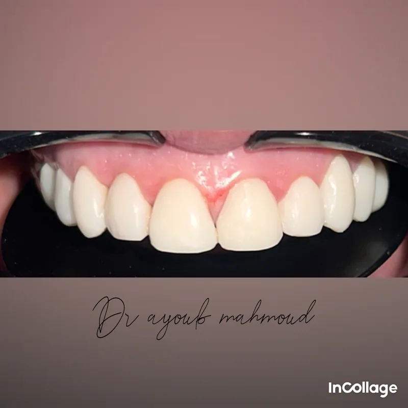 Cabinet Dentaire Dr. Ayoub Mahmoud Chirurgien Dentiste photo 1