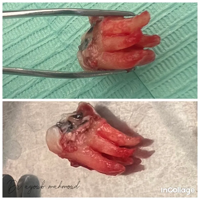 Cabinet Dentaire Dr. Ayoub Mahmoud Chirurgien Dentiste photo 2