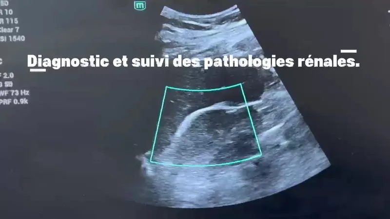 صورة 2 من Cabinet d'urologie et d'andrologie Dr Malki mohamed amine