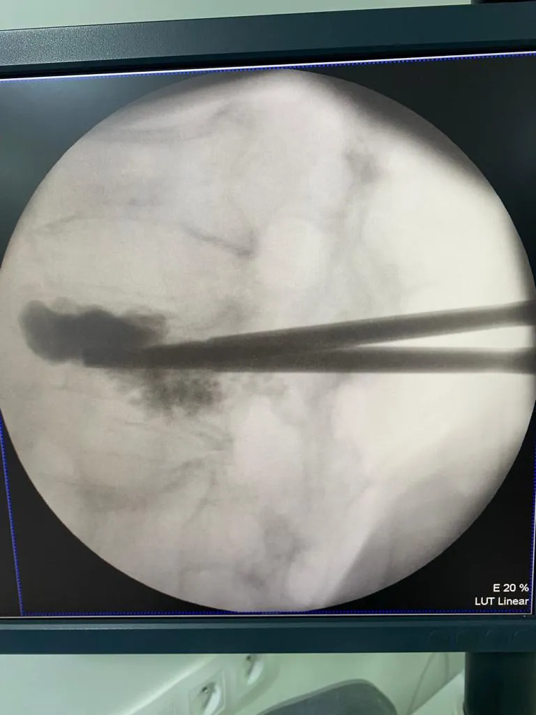 Photo 2 de Dr Oudrhiri Mohammed yassaad - Neurochirurgien, Professeur Agrégé, Rabat, Maroc