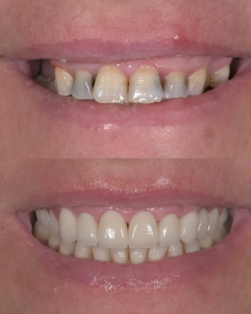 صورة 2 من Cabinet Dentaire Dr. Aya El Yazami Chirurgien dentiste