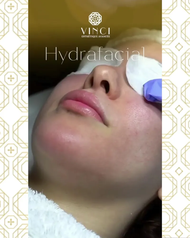 VINCI ESTHETIQUE AVANCEE - SALE/RABAT photo 3