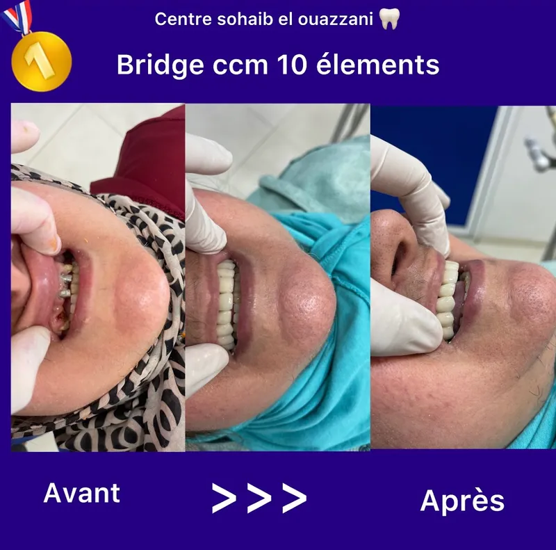 Photo 2 de Centre dentaire PERFECT SMILE- Dr LASSERI MOHSSINE