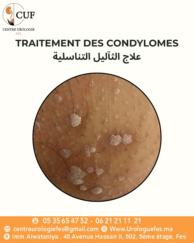صورة 4 من Centre d'Urologie de Fès - Dr CHEIKH Mohammed & Dr MARRAKCHI Jaafar - Urologue & Andrologue