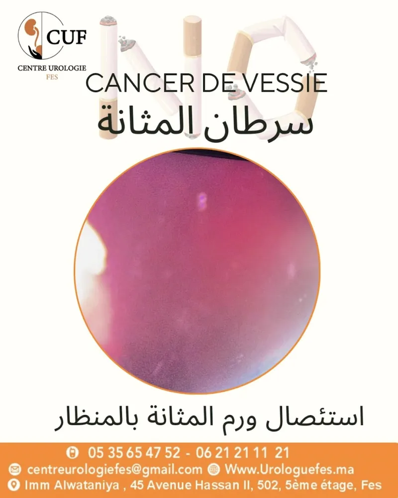 صورة 3 من Centre d'Urologie de Fès - Dr CHEIKH Mohammed & Dr MARRAKCHI Jaafar - Urologue & Andrologue