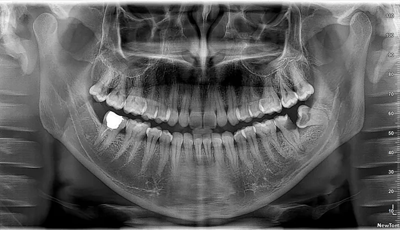 Photo 3 de Centre dentaire MOUTAOUAKIL مركز طب الاسنان متوكل