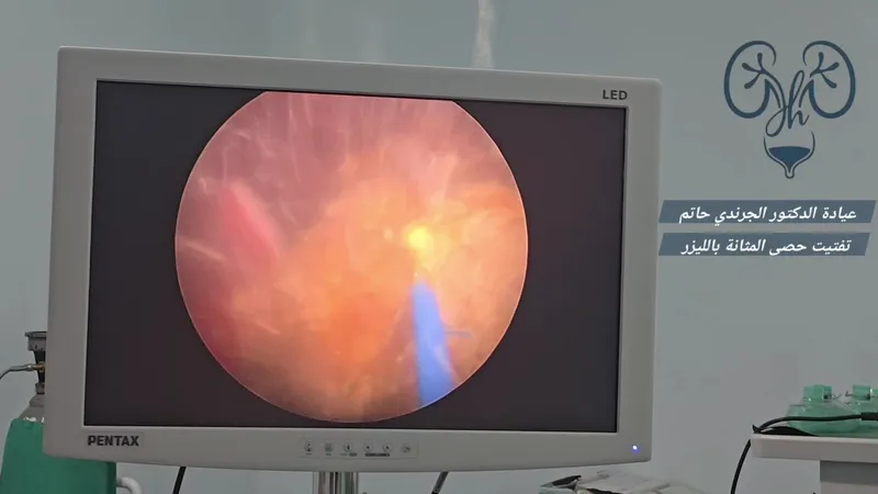 صورة 4 من Dr Hatim Jroundi Urologue Oujda