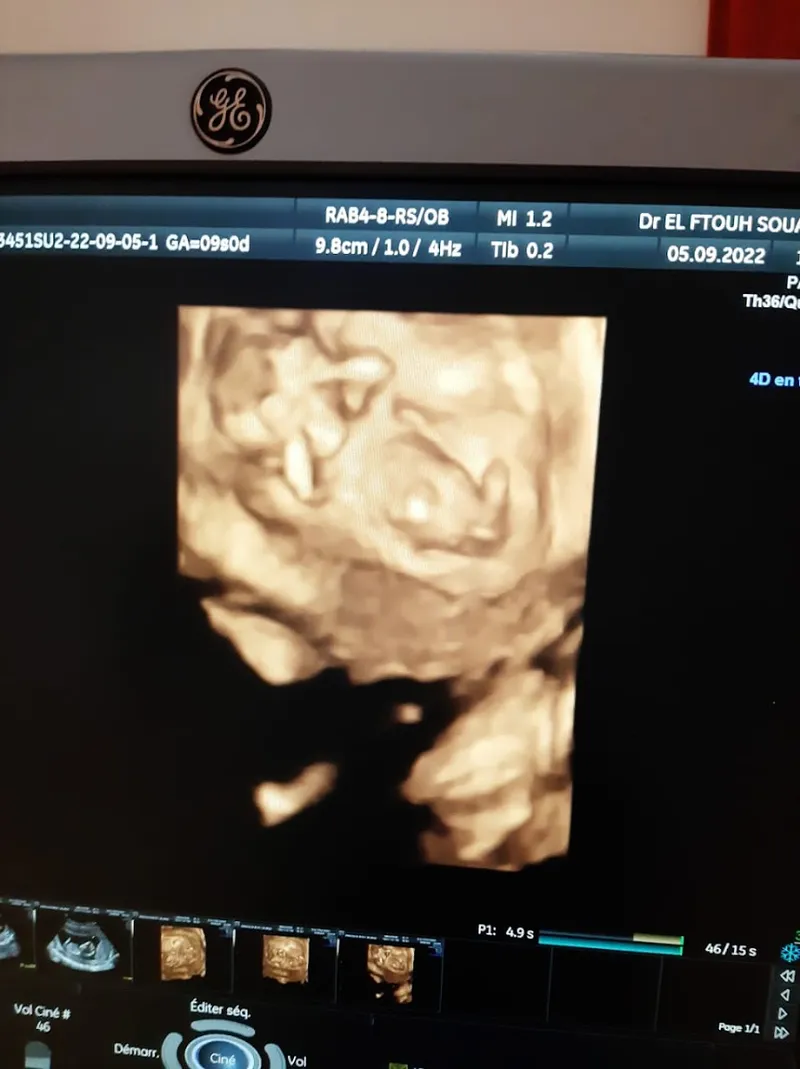 Dr Hani Pneumologue photo 4