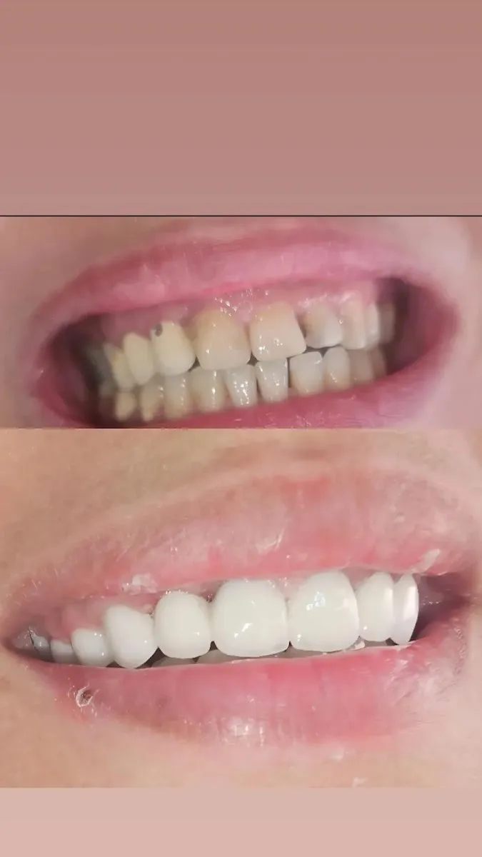 صورة 2 من Centre dentaire multidisciplinaire Dr. Mounaim Kelthoum Chirurgienne Dentiste
