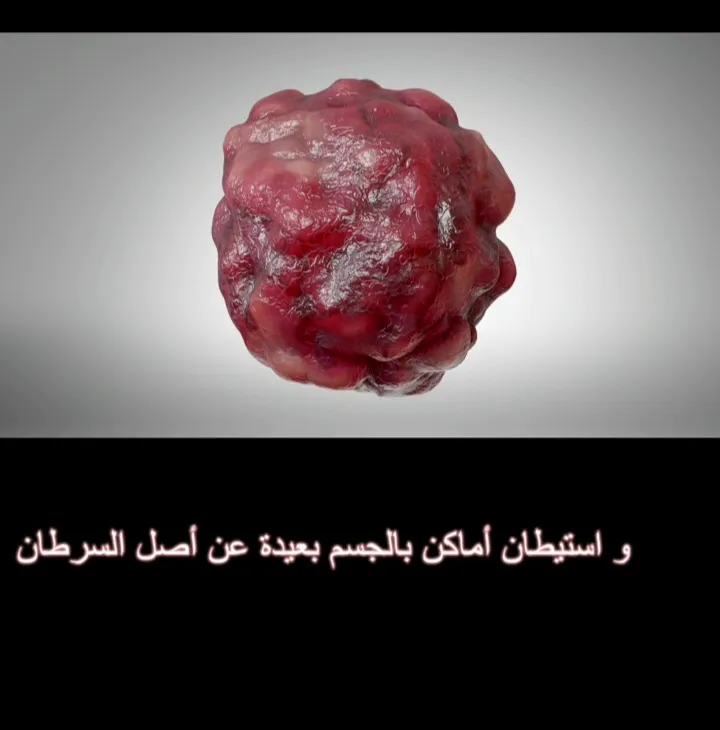 Photo 3 de DOCTEUR EDDAOUALLINE Hanane - CANCEROLOGUE - ONCOLOGUE RADIOTHERAPEUTE طبيبة أخصائية تشخيص و علاج السرطان