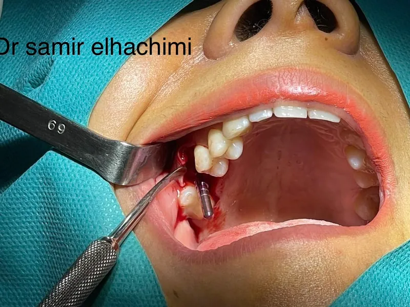 صورة 2 من Dr Samir Elhachimi(cabinet dentaire)
