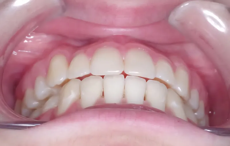 صورة 2 من Cabinet Dentaire, Orthodontie, Parodontologie, Prothèse Fixe Dr. Ahmed El Antouri Chirurgien Dentiste