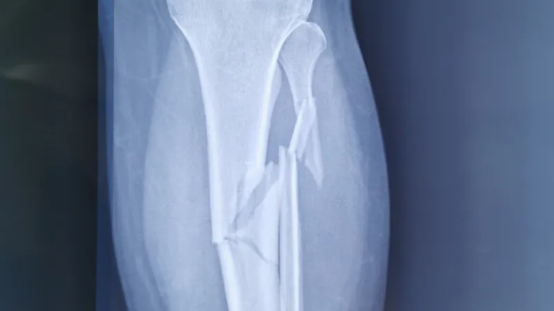 Cabinet de Traumatologie & Orthopédie à Casablanca – Dr. YOUNESS ALLALI – Centre de Chirurgie Orthopédique et Traumatologique photo 4