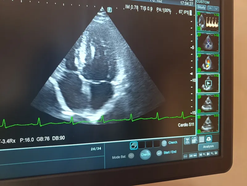 صورة 2 من Dr Bourouhou Zaineb Cardiologue Témara Rabat Cabinet de cardiologie Témara Rabat عيادة القلب والشرايين